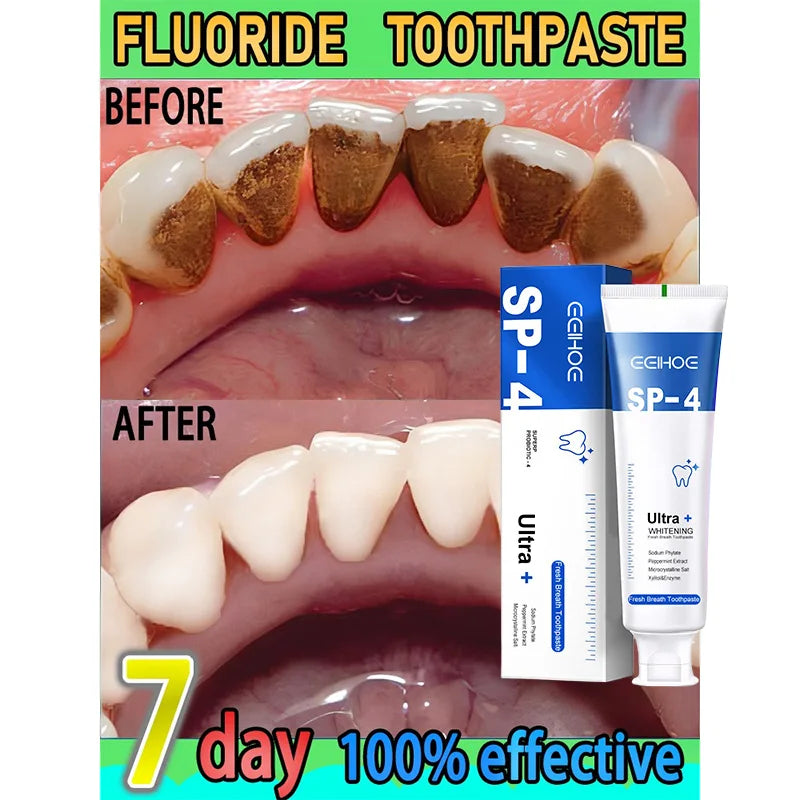 All Smiles -Brightening & Stain Removing Probiotic Toothpaste