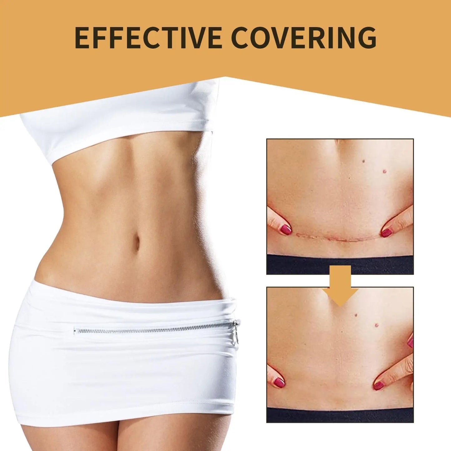 Tattoo And Scar Cover Up Patch (6 pcs)