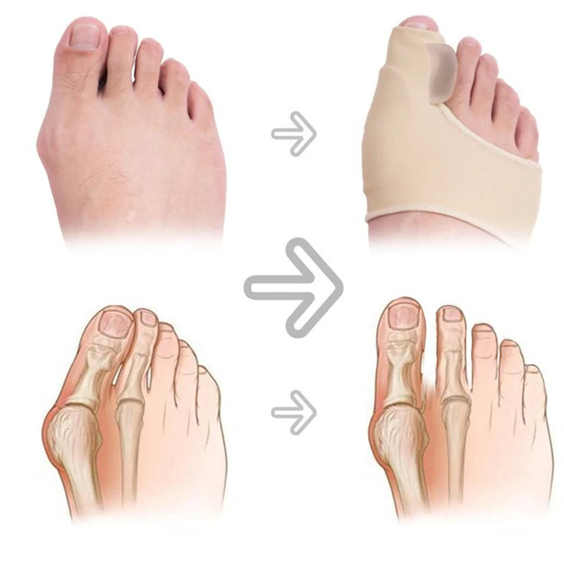 Premium Bunion Corrector Sock