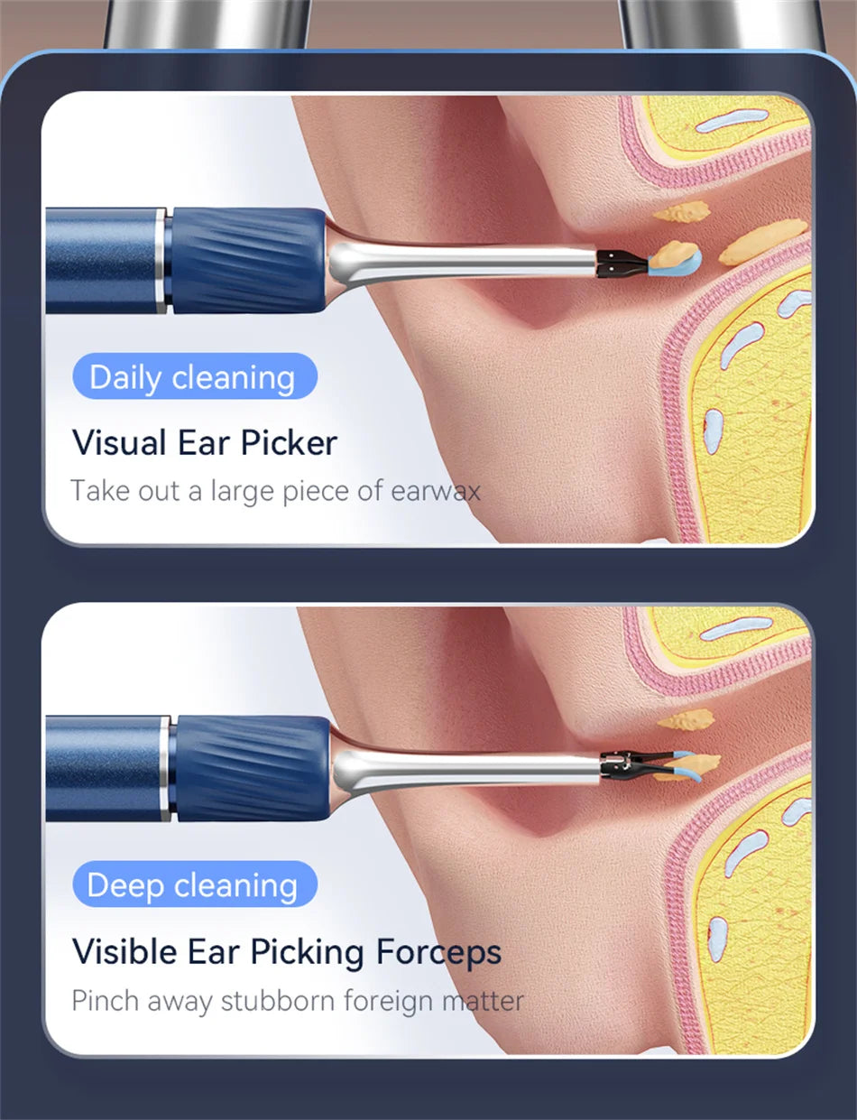 Loft Ear Wax Remoner